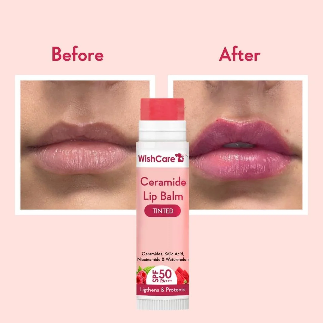 WishCare Tinted Ceramide Lip Balm with SPF50 PA+++ - Kojic Acid & Niacinamide - For Lip Lightening & Protection 5gm - image 1